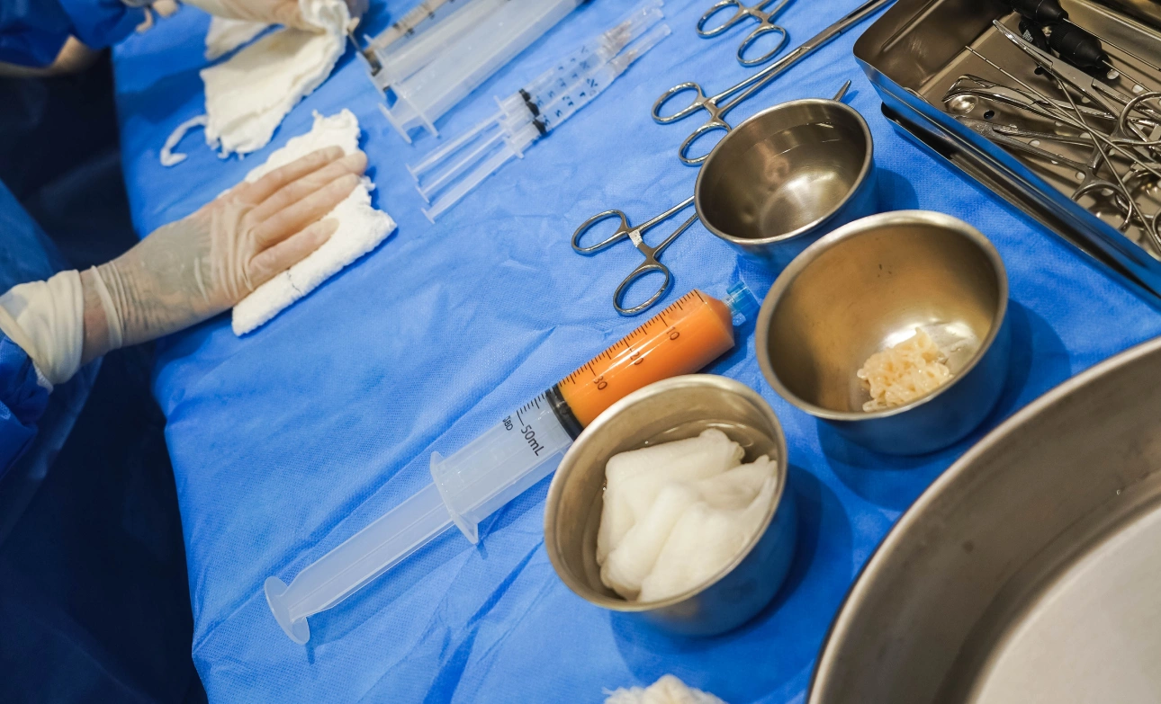 Mesa cirúrgica com seringas e material para lipoenxertia