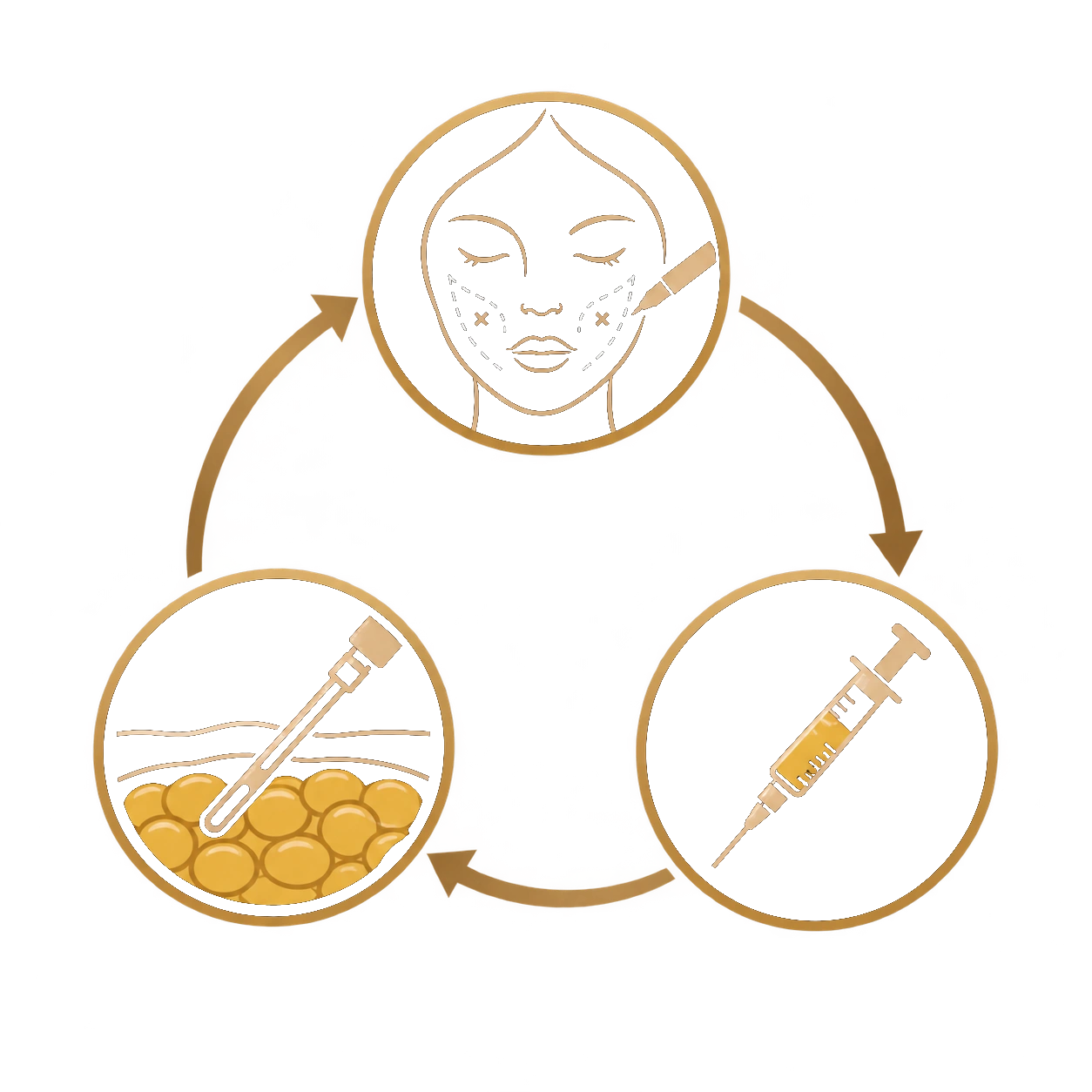 Marcação do paciente, coleta e aplicação da gordura autóloga